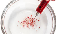 spherification