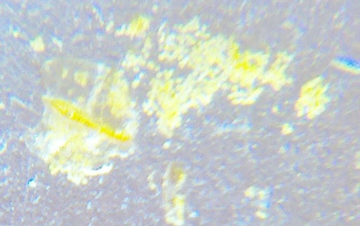 pollen as seen through the mini microscope