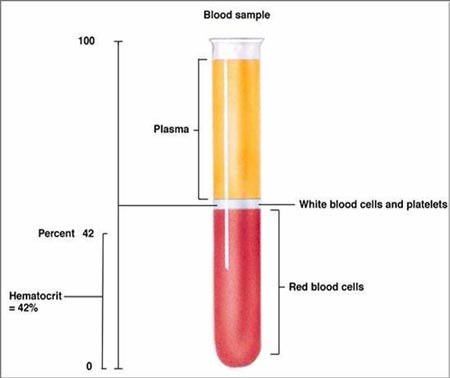 test tube of blood that had been centrifuged
